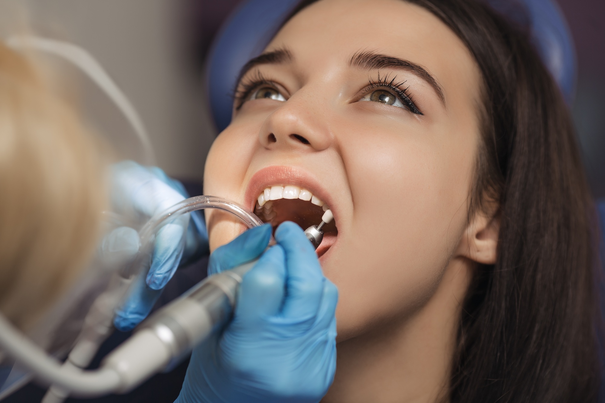 Dentist polishing patient teeth at the dental office.